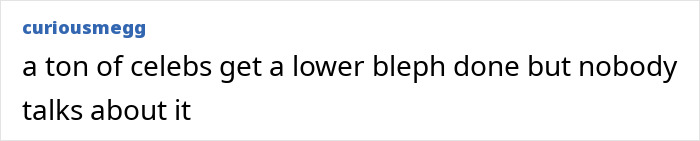 Doctor Reveals Reason Behind “Tired Eyes” That Has Stars Looking Sleepy Despite Youthful Faces