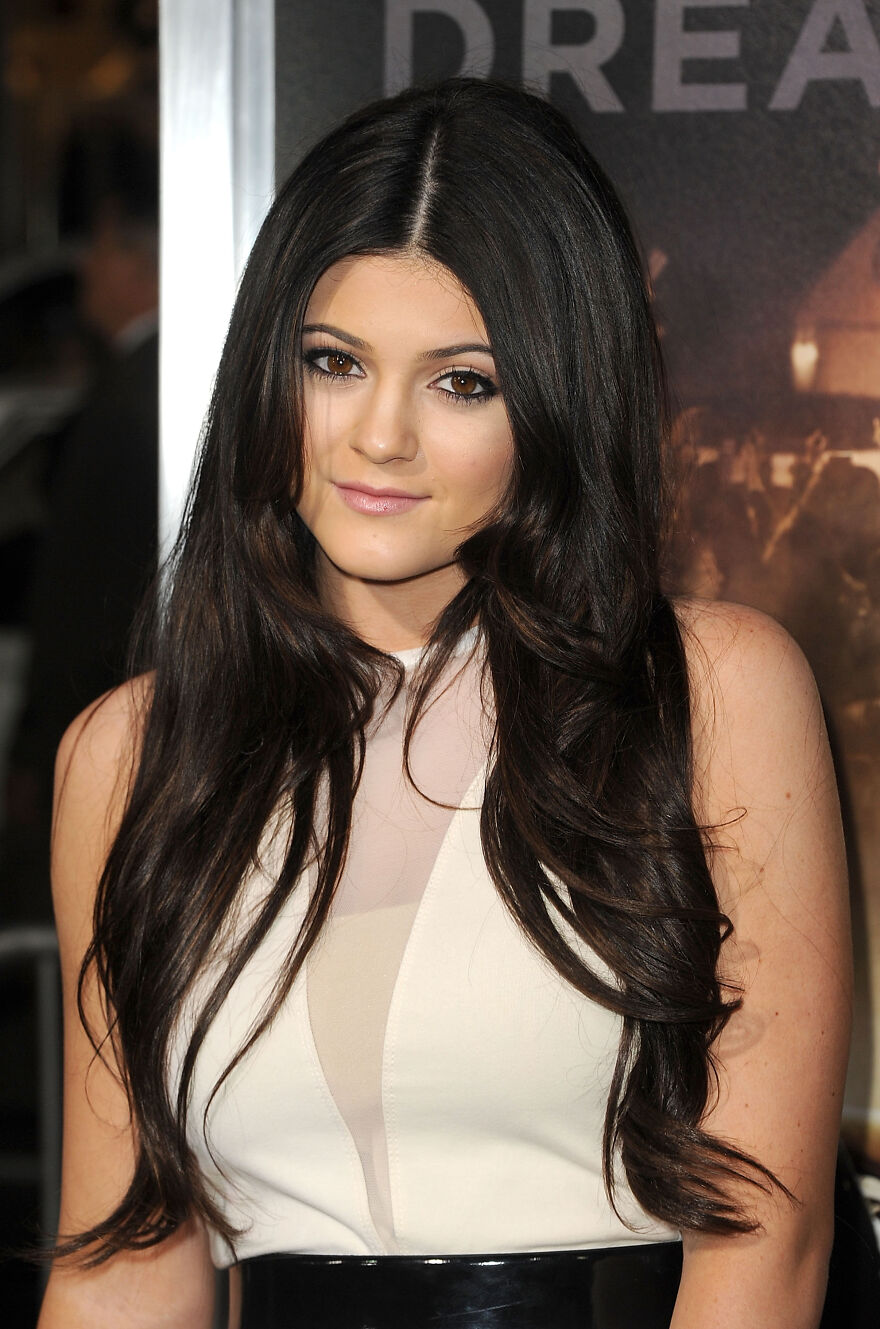 Kylie Jenner Before And After: What She Confirmed And What She Denies