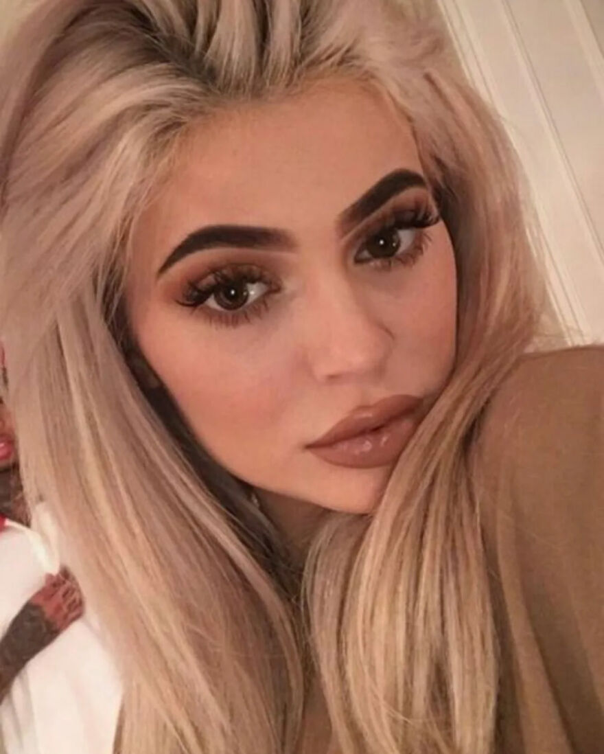 Kylie Jenner Before And After: What She Confirmed And What She Denies