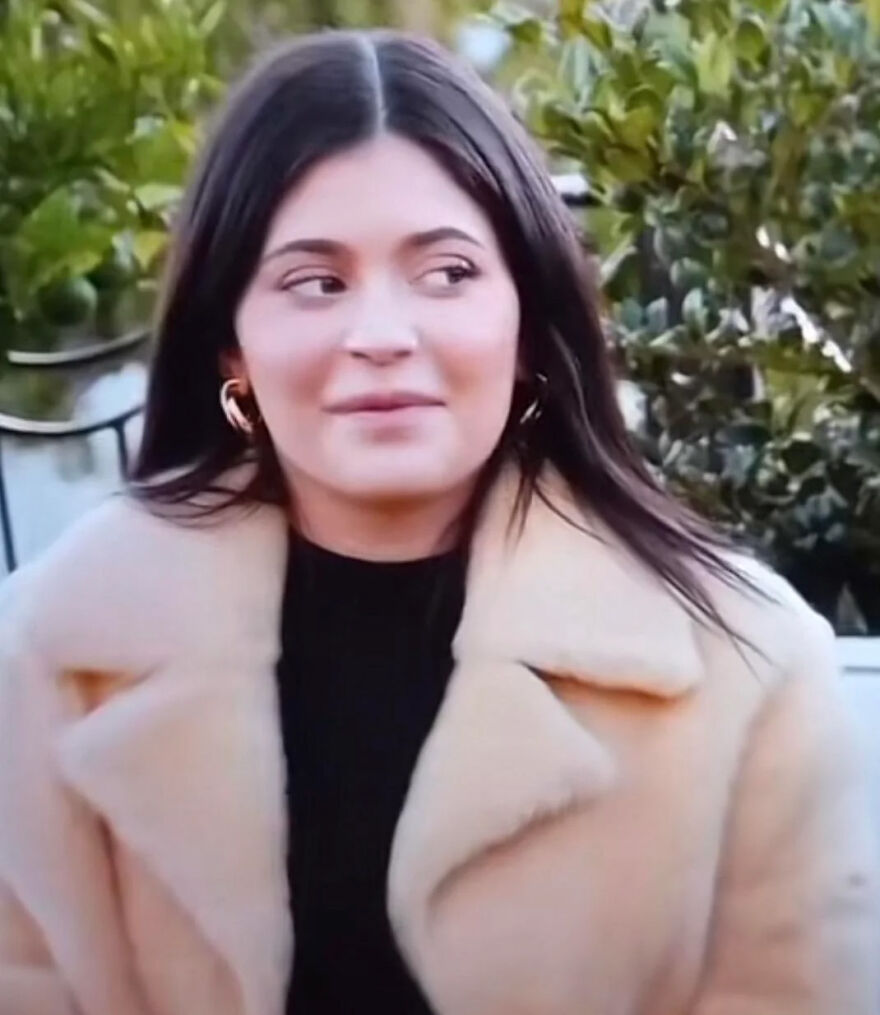 Kylie Jenner Before And After: What She Confirmed And What She Denies