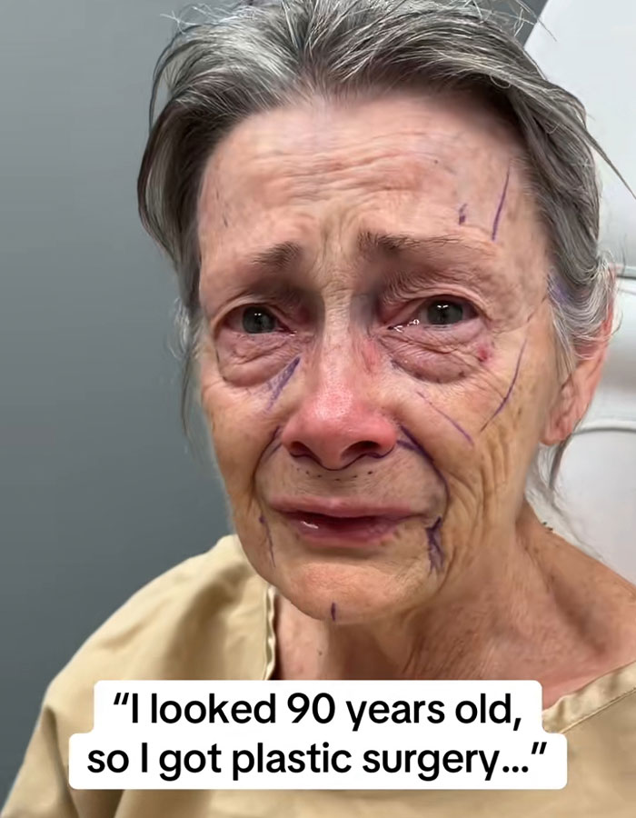 &lsquo;Miracle&rsquo; Plastic Surgeon Goes Viral After Transforming Grandma To Look Decades Younger