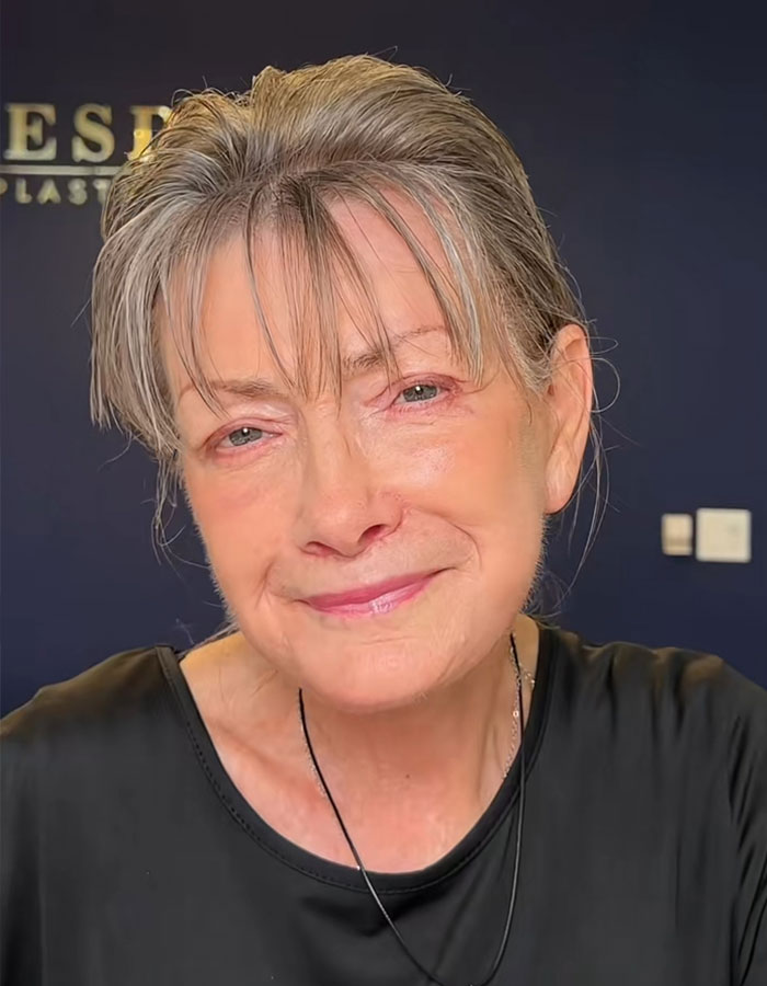 &lsquo;Miracle&rsquo; Plastic Surgeon Goes Viral After Transforming Grandma To Look Decades Younger