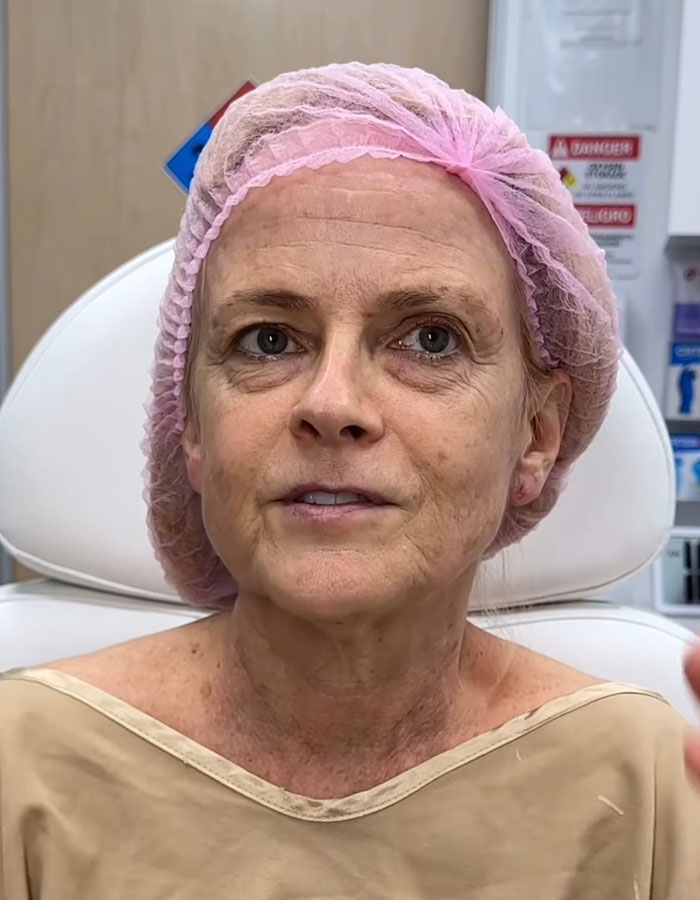 &lsquo;Miracle&rsquo; Plastic Surgeon Goes Viral After Transforming Grandma To Look Decades Younger