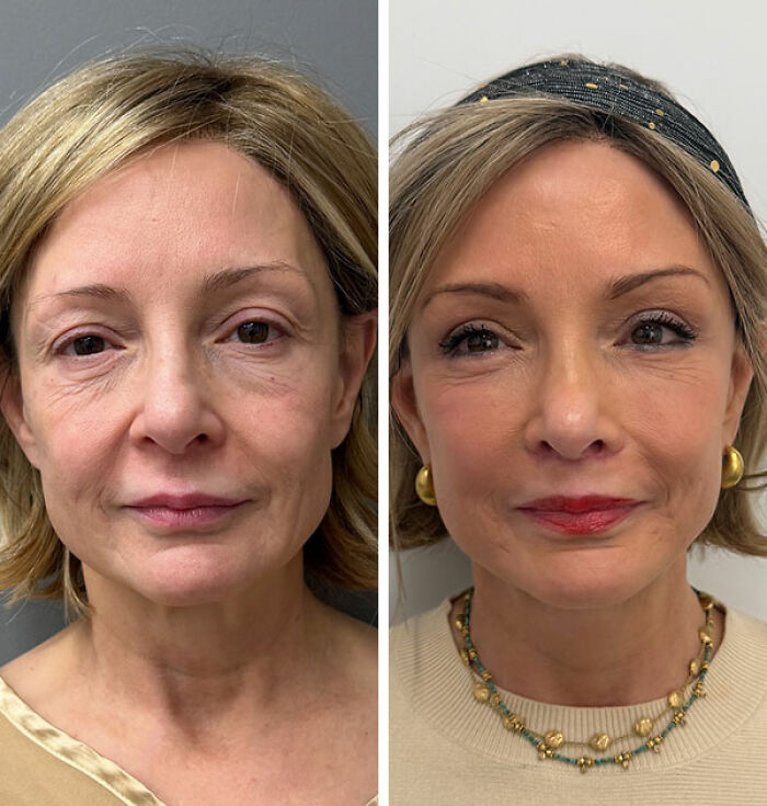 &lsquo;Miracle&rsquo; Plastic Surgeon Goes Viral After Transforming Grandma To Look Decades Younger