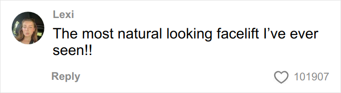 &lsquo;Miracle&rsquo; Plastic Surgeon Goes Viral After Transforming Grandma To Look Decades Younger