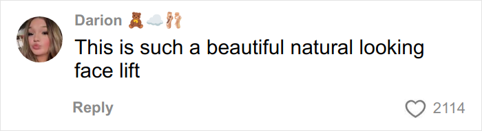 &lsquo;Miracle&rsquo; Plastic Surgeon Goes Viral After Transforming Grandma To Look Decades Younger