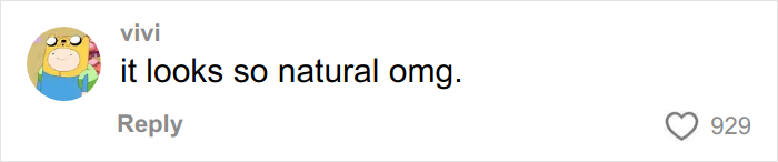 &lsquo;Miracle&rsquo; Plastic Surgeon Goes Viral After Transforming Grandma To Look Decades Younger