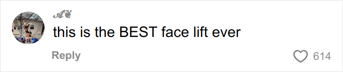 &lsquo;Miracle&rsquo; Plastic Surgeon Goes Viral After Transforming Grandma To Look Decades Younger