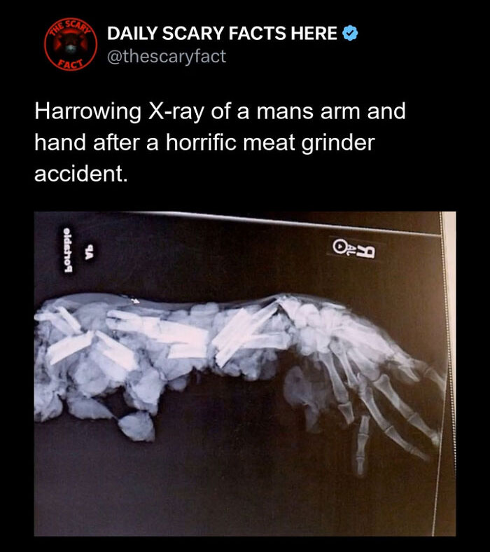 “This Scary Fact”: 83 Facts To Scroll Through In The Darkness And Regret It (New Pics)