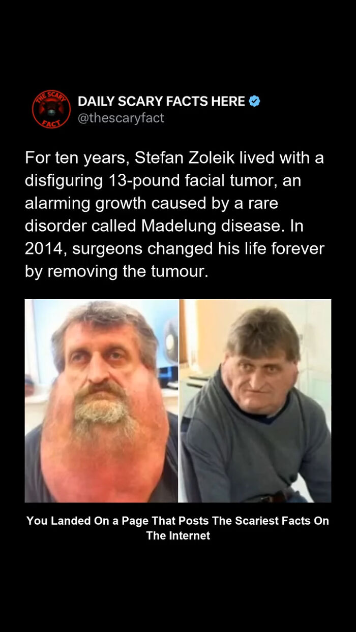 “This Scary Fact”: 83 Facts To Scroll Through In The Darkness And Regret It (New Pics)