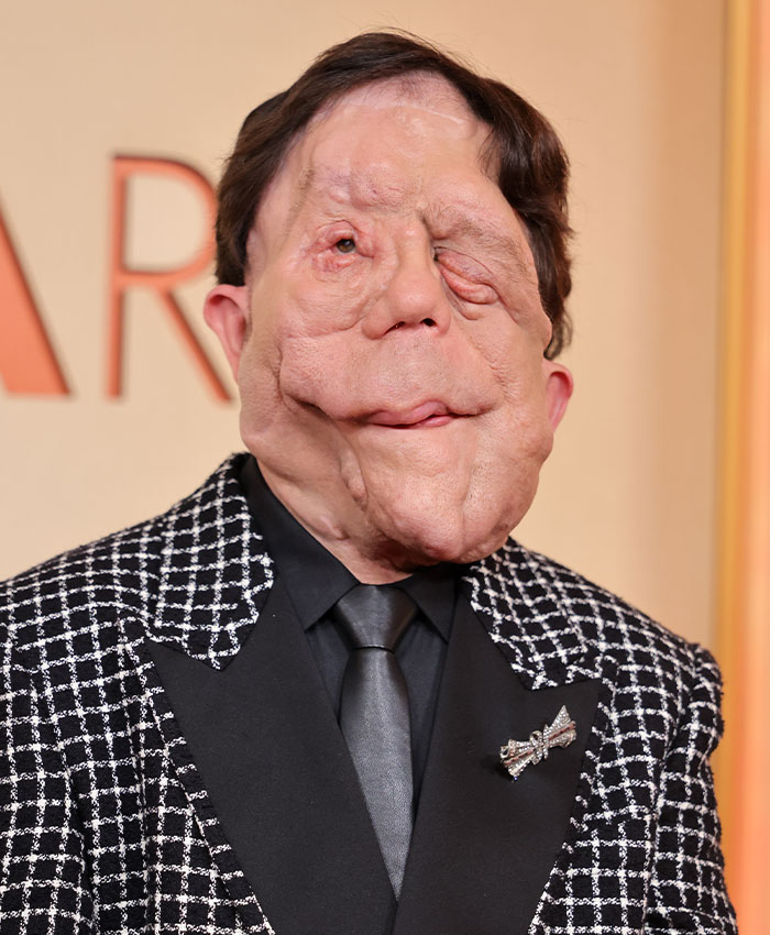 Adam Pearson Joins Fans In Calling Out Comedian’s Offensive Tweet About Him Adam Pearson Joins Fans In Calling Out Comedian’s Offensive Tweet About Him