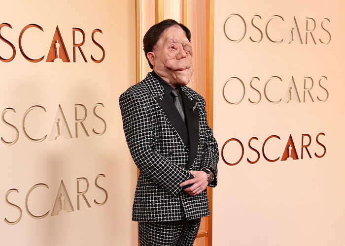 Adam Pearson Joins Fans In Calling Out Comedian’s Offensive Tweet About Him Adam Pearson Joins Fans In Calling Out Comedian’s Offensive Tweet About Him