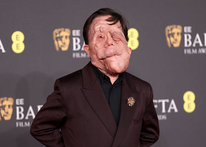 Adam Pearson Joins Fans In Calling Out Comedian’s Offensive Tweet About Him Adam Pearson Joins Fans In Calling Out Comedian’s Offensive Tweet About Him