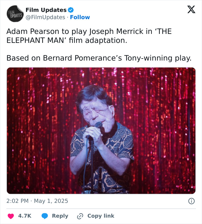 Adam Pearson Joins Fans In Calling Out Comedian’s Offensive Tweet About Him Adam Pearson Joins Fans In Calling Out Comedian’s Offensive Tweet About Him