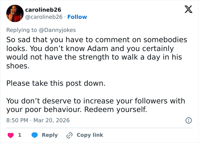 Adam Pearson Joins Fans In Calling Out Comedian’s Offensive Tweet About Him Adam Pearson Joins Fans In Calling Out Comedian’s Offensive Tweet About Him