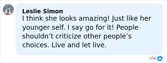 Denise Richards Reveals Dramatic Facelift Transformation In Before-And-After Photos Denise Richards Reveals Dramatic Facelift Transformation In Before-And-After Photos