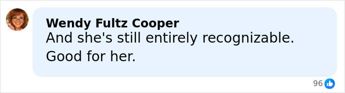 Denise Richards Reveals Dramatic Facelift Transformation In Before-And-After Photos Denise Richards Reveals Dramatic Facelift Transformation In Before-And-After Photos