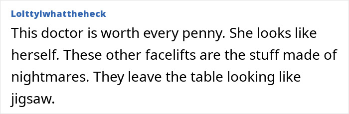 Denise Richards Reveals Dramatic Facelift Transformation In Before-And-After Photos Denise Richards Reveals Dramatic Facelift Transformation In Before-And-After Photos