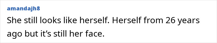 Denise Richards Reveals Dramatic Facelift Transformation In Before-And-After Photos Denise Richards Reveals Dramatic Facelift Transformation In Before-And-After Photos