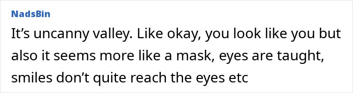 Denise Richards Reveals Dramatic Facelift Transformation In Before-And-After Photos Denise Richards Reveals Dramatic Facelift Transformation In Before-And-After Photos