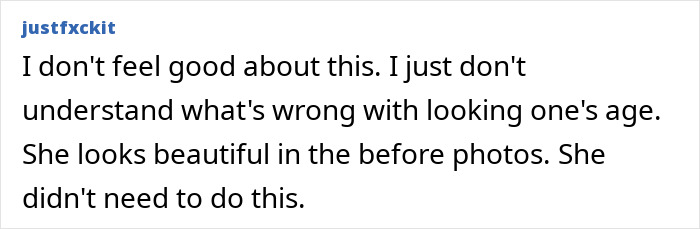 Denise Richards Reveals Dramatic Facelift Transformation In Before-And-After Photos Denise Richards Reveals Dramatic Facelift Transformation In Before-And-After Photos