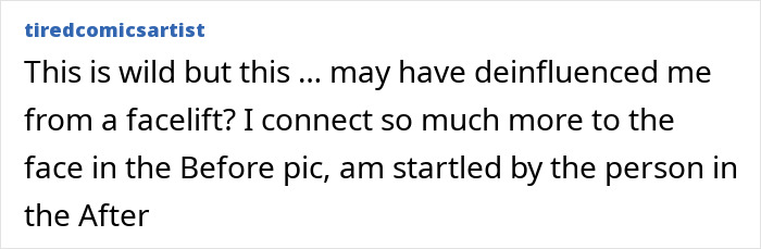 Denise Richards Reveals Dramatic Facelift Transformation In Before-And-After Photos Denise Richards Reveals Dramatic Facelift Transformation In Before-And-After Photos