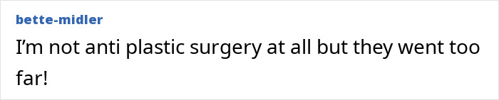 Denise Richards Reveals Dramatic Facelift Transformation In Before-And-After Photos Denise Richards Reveals Dramatic Facelift Transformation In Before-And-After Photos