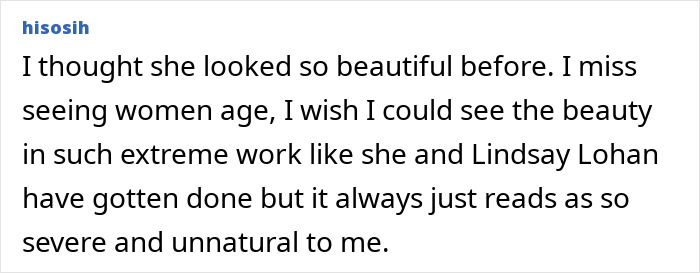 Denise Richards Reveals Dramatic Facelift Transformation In Before-And-After Photos Denise Richards Reveals Dramatic Facelift Transformation In Before-And-After Photos