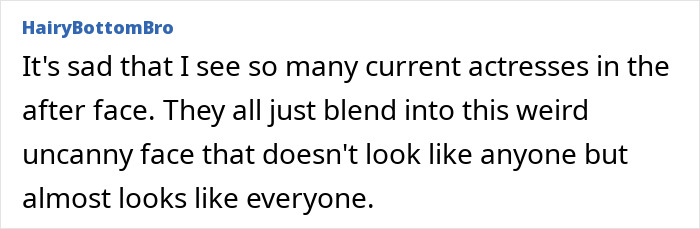 Denise Richards Reveals Dramatic Facelift Transformation In Before-And-After Photos Denise Richards Reveals Dramatic Facelift Transformation In Before-And-After Photos