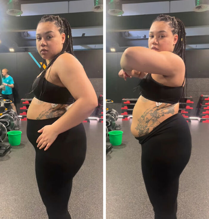 “Living A Nightmare”: ‘Bridgerton’ Actress Shows The Impact Her Mental Health Had On Her Body