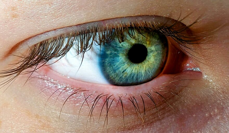 How Rare Are Green Eyes, And What Genetics Says About Their Origins