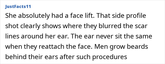 Anne Hathaway Shuts Down When Asked About Appearance Days After Fans Spotted Something Off About Oscars Look