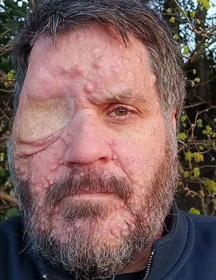 35 Disturbing Images And Facts Proving That Real Life Can Be An Absolute Nightmare 35 Disturbing Images And Facts Proving That Real Life Can Be An Absolute Nightmare