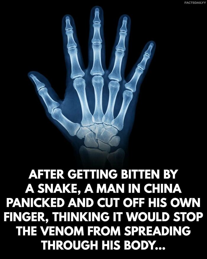 &ldquo;Can&rsquo;t Make This Up&rdquo;: 79 Surprising Facts You May Not Be Able To Forget (New Pics)