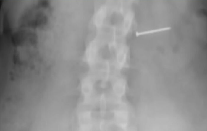 Woman Wins $14 Million After Ice Cream Left Her Unable To Have Children