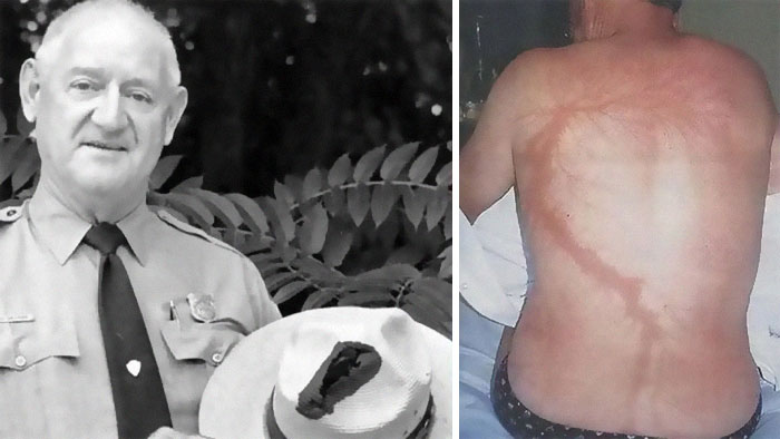 &ldquo;Should Have Been 100% Fatal&rdquo;: 49 People Who Survived Against All Odds