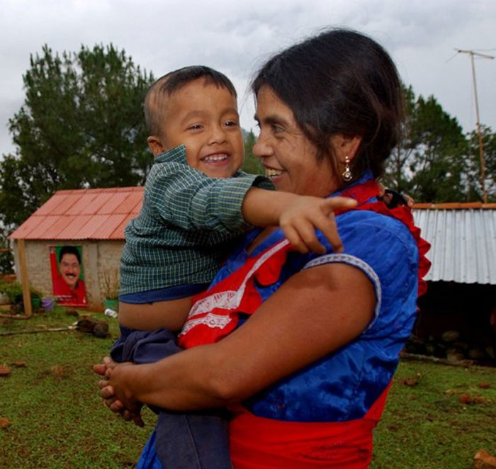 &ldquo;Should Have Been 100% Fatal&rdquo;: 49 People Who Survived Against All Odds