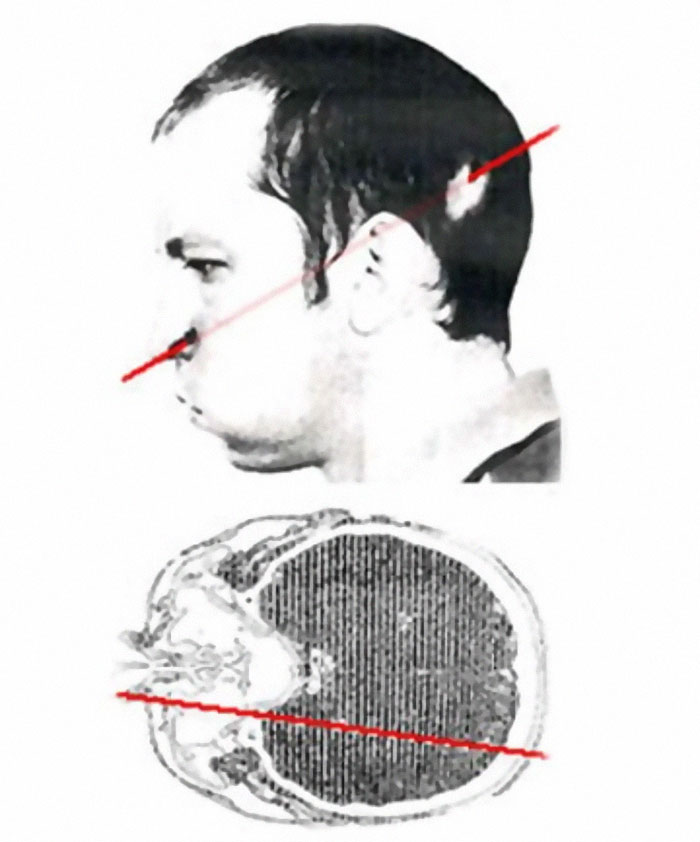 &ldquo;Should Have Been 100% Fatal&rdquo;: 49 People Who Survived Against All Odds