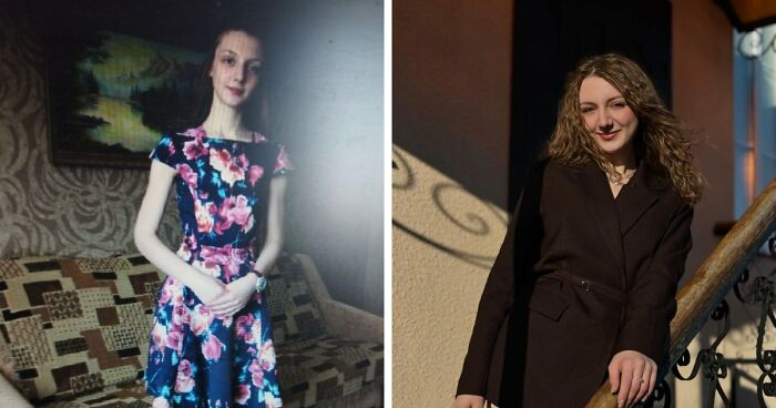 31 Truly Unbelievable Transformations From People Who Totally Changed Their Lives In 3 Years 31 Truly Unbelievable Transformations From People Who Totally Changed Their Lives In 3 Years