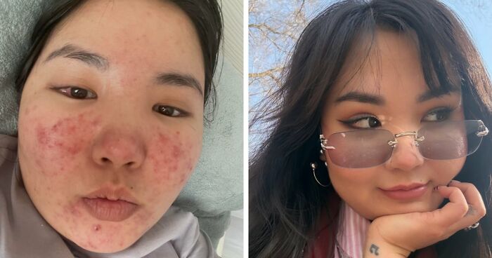 31 Truly Unbelievable Transformations From People Who Totally Changed Their Lives In 3 Years 31 Truly Unbelievable Transformations From People Who Totally Changed Their Lives In 3 Years