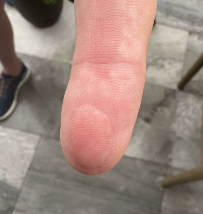 65 Photos Of The Human Body In Shapes And Conditions You Might Not Have Seen Before