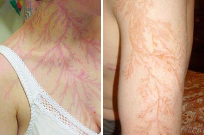 65 Photos Of The Human Body In Shapes And Conditions You Might Not Have Seen Before