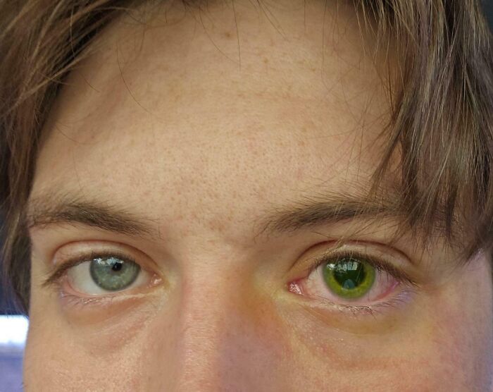 65 Photos Of The Human Body In Shapes And Conditions You Might Not Have Seen Before