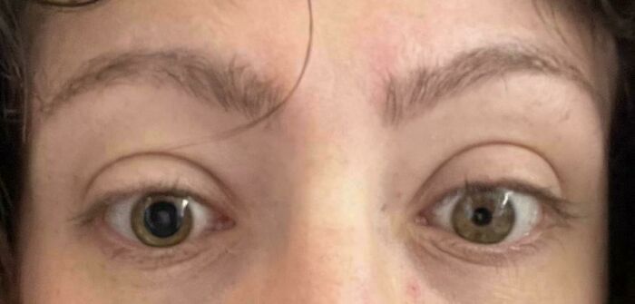 65 Photos Of The Human Body In Shapes And Conditions You Might Not Have Seen Before