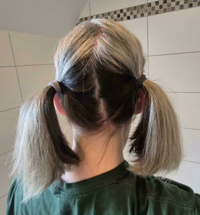 65 Photos Of The Human Body In Shapes And Conditions You Might Not Have Seen Before