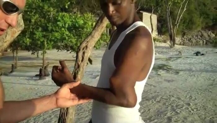 65 Photos Of The Human Body In Shapes And Conditions You Might Not Have Seen Before