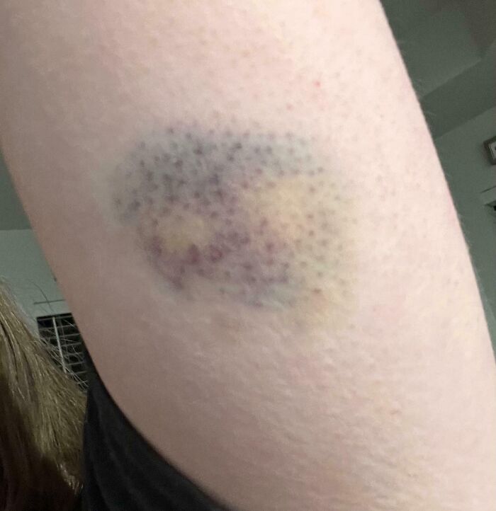 65 Photos Of The Human Body In Shapes And Conditions You Might Not Have Seen Before