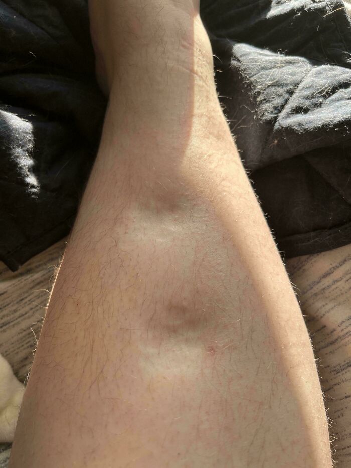 65 Photos Of The Human Body In Shapes And Conditions You Might Not Have Seen Before