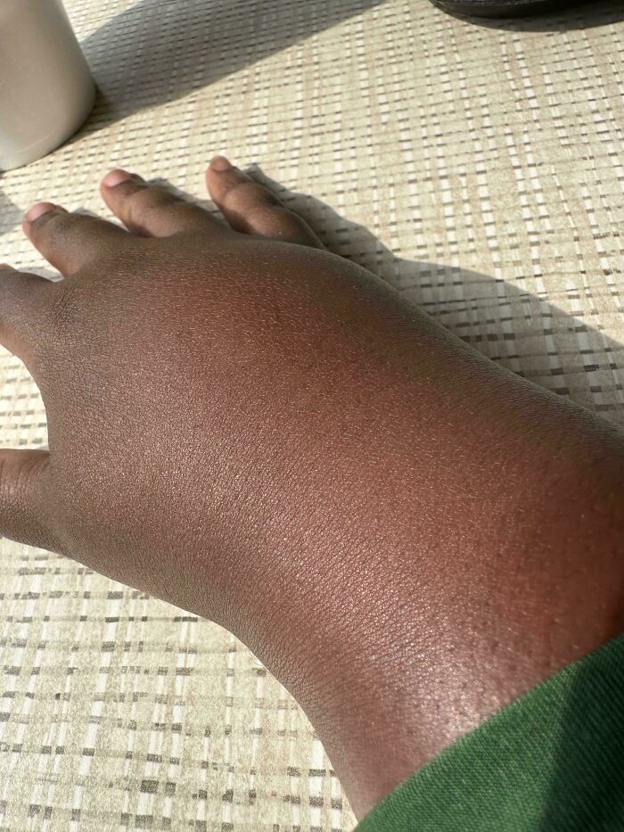 65 Photos Of The Human Body In Shapes And Conditions You Might Not Have Seen Before