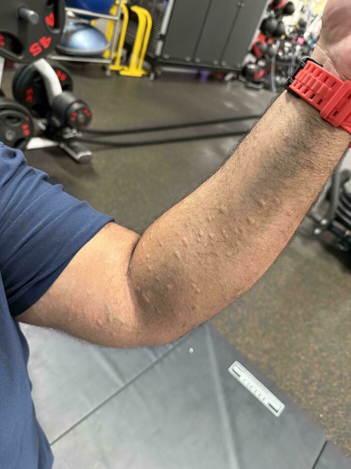 65 Photos Of The Human Body In Shapes And Conditions You Might Not Have Seen Before